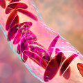Difference Between Sickle Cell Anemia and Sickle Cell Disease: Inside the Genetics and Treatments You Should Understand