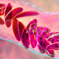 Why Does Sickle Cell Anemia Only Affect African American Individuals? The Evolutionary and Medical Perspective