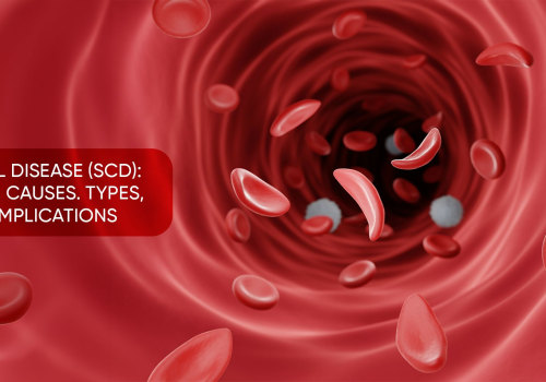 Difference Between Sickle Cell Anemia and Disease: Shocking Facts That Affect Your Understanding of Symptoms and Risks